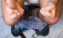 anal fissure anal fissure treatment los angeles